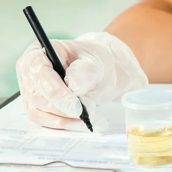 barbiturates, screen urine test